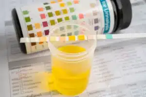 درمان مشکلات ادراری | دکتر شیوا هورشاد